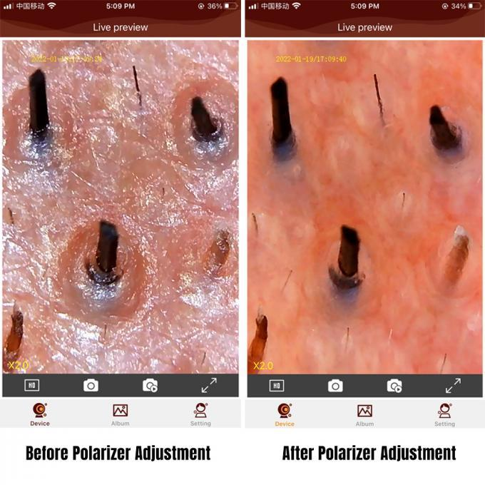 Microscópio digital de dermatologia Lupa eletrônica Endoscópio de ampliação de 2 MP